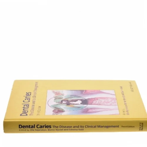 Dental caries : the disease and its clinical management (Bog)