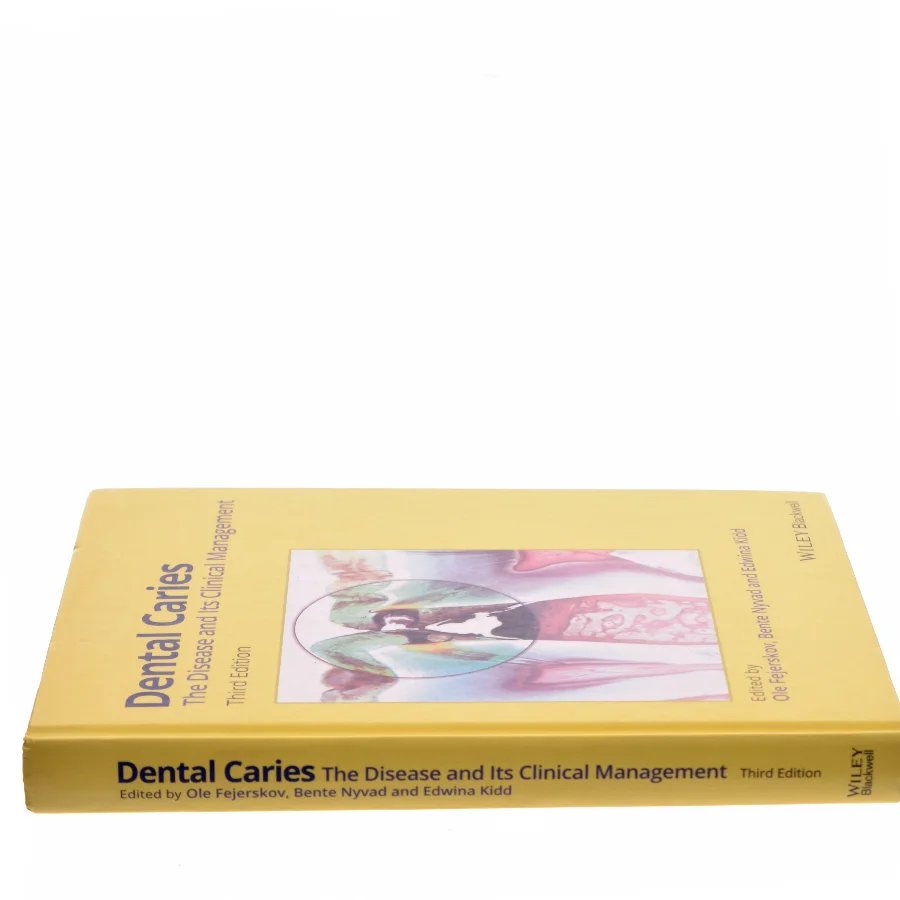 Dental caries : the disease and its clinical management (Bog)