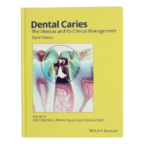 Dental caries : the disease and its clinical management (Bog)