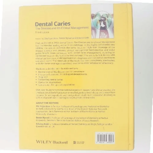 Dental caries : the disease and its clinical management (Bog)