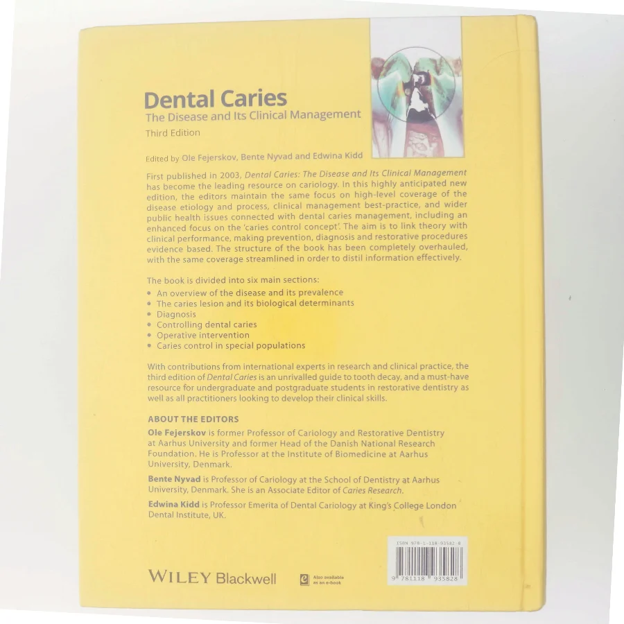 Dental caries : the disease and its clinical management (Bog)