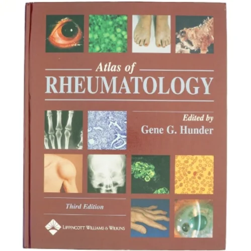 Atlas of Rheumatology af Gene G. Hunder (Bog)