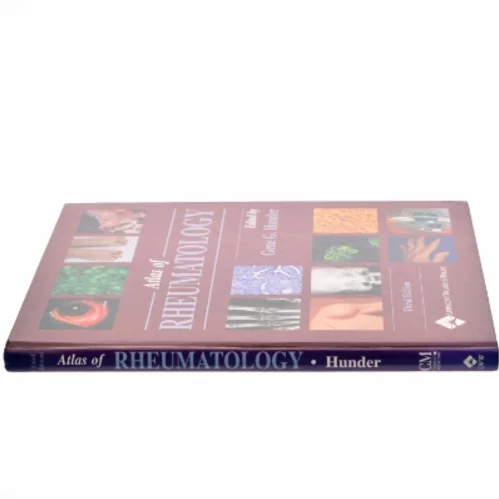 Atlas of Rheumatology af Gene G. Hunder (Bog)