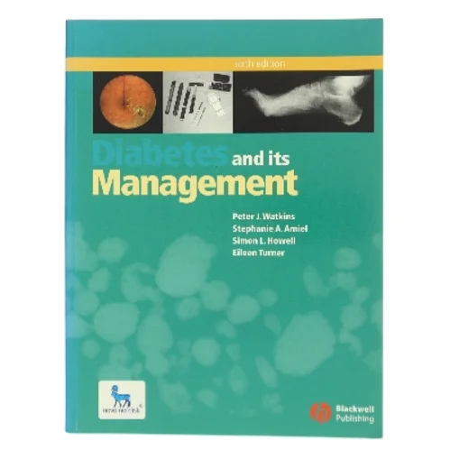 Diabetes and Its Management (Bog)