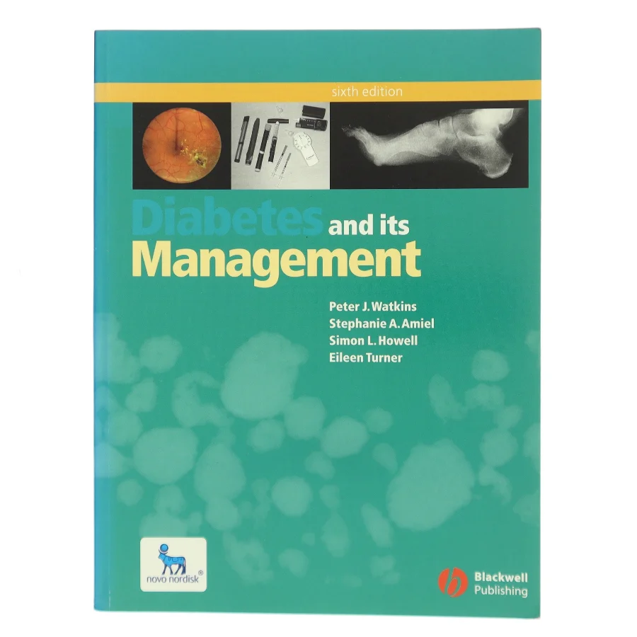 Diabetes and Its Management (Bog)