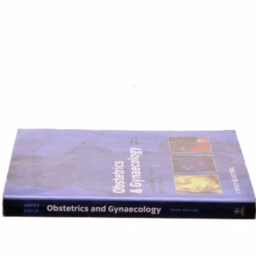 Obstetrics and Gynaecology by Tim, Impey, Lawrence Child af Lawrence Impey (Bog)