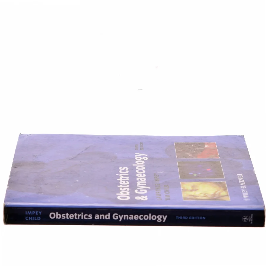 Obstetrics and Gynaecology by Tim, Impey, Lawrence Child af Lawrence Impey (Bog)