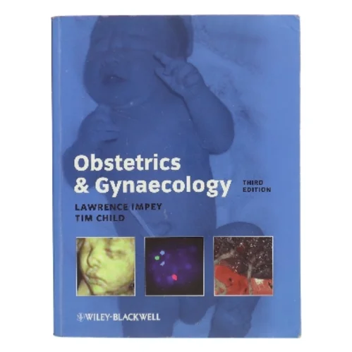 Obstetrics and Gynaecology by Tim, Impey, Lawrence Child af Lawrence Impey (Bog)