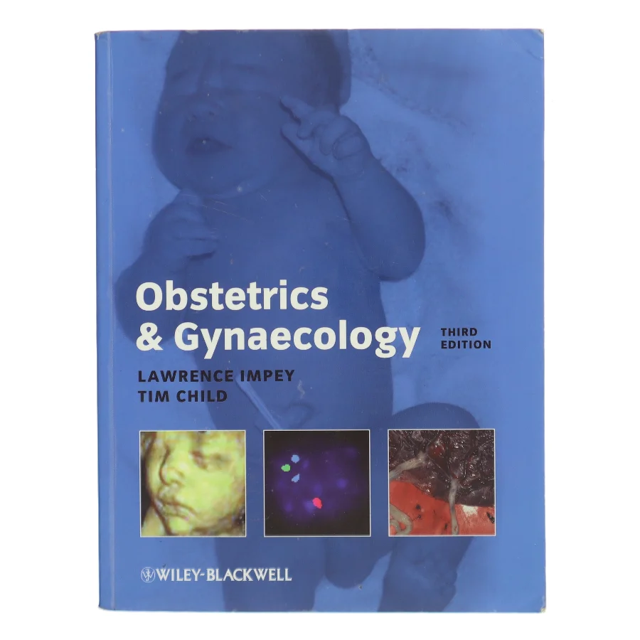 Obstetrics and Gynaecology by Tim, Impey, Lawrence Child af Lawrence Impey (Bog)