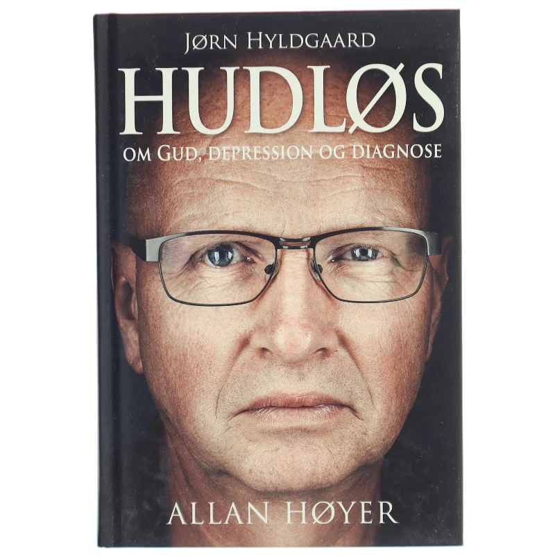 Hudløs : Jørn Hyldgaard - om Gud, depression og diagnose af Allan Høyer (f. 1965-01-11) (Bog)
