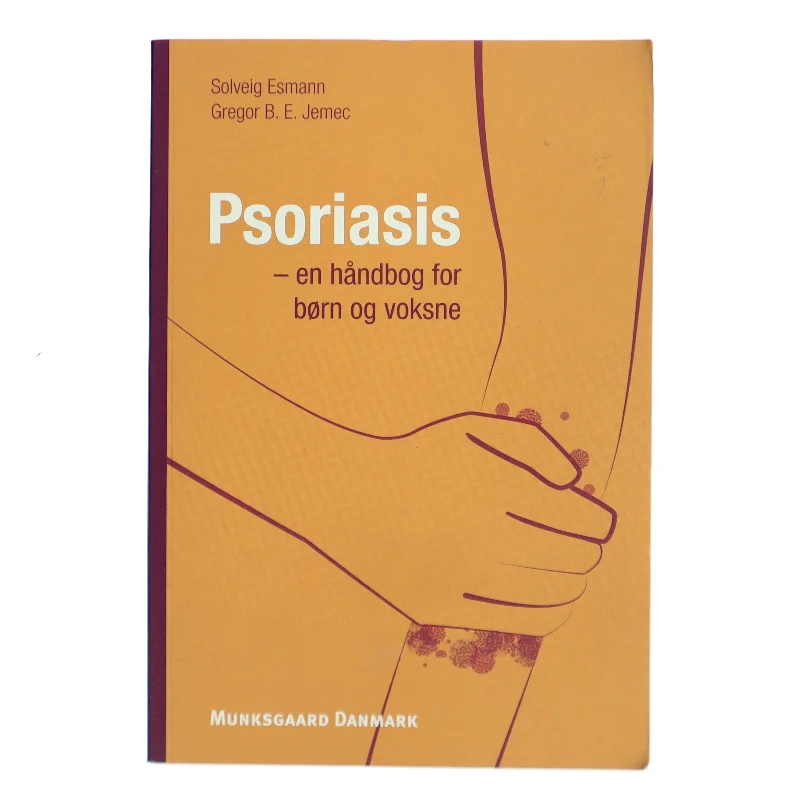 Psoriasis : en håndbog for børn og voksne (Bog)